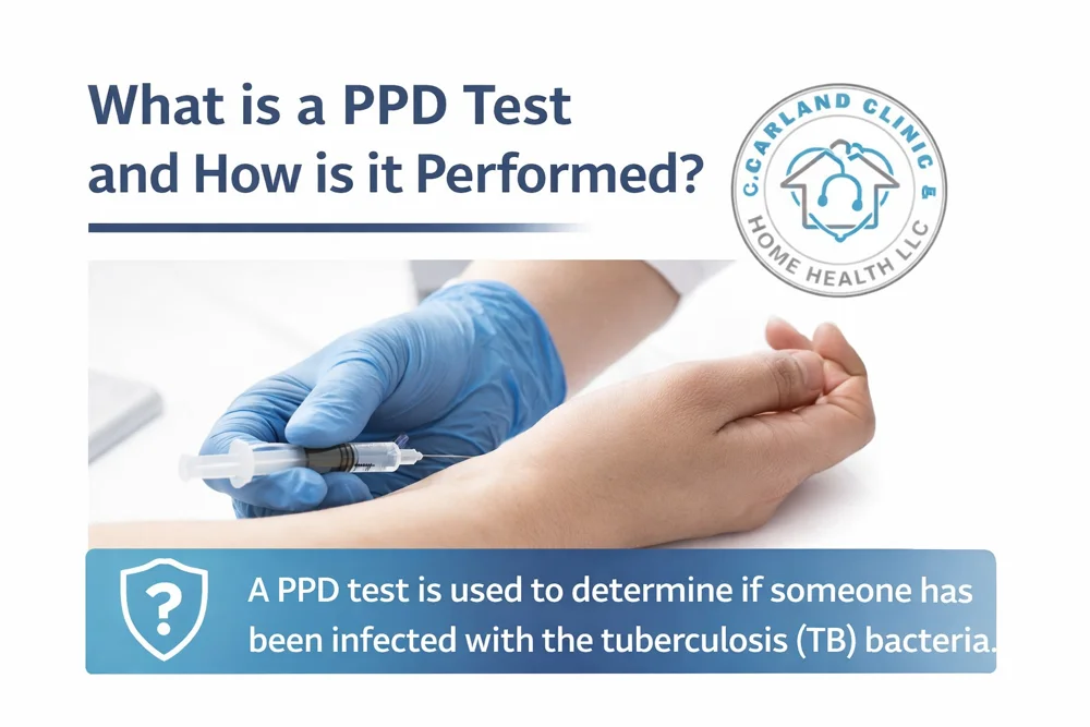 What is a PPD Test?